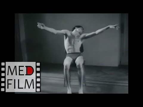 Видео: Нейродегенерация. Болезнь Галлервордена-Шпатца, академик К.В.Судако́в © Hallervorden-Spatz disease