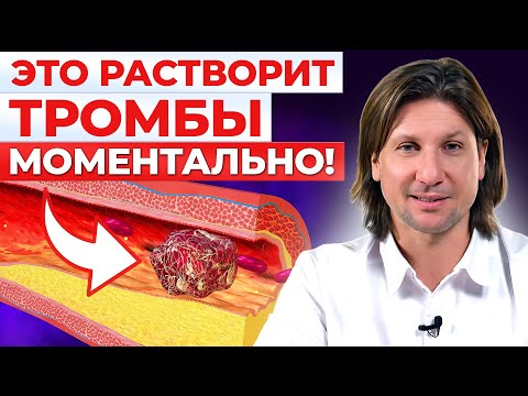 Видео: ЭТИ продукты разжижают ТРОМБЫ! Как спасти себя от тромбоза?