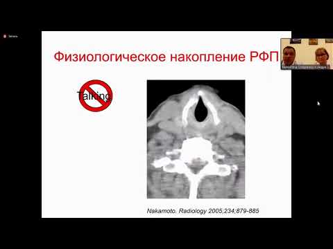 Видео: Станжевский А.А. «Применение ПЭТ-КТ в диагностике опухолей головы и шеи»