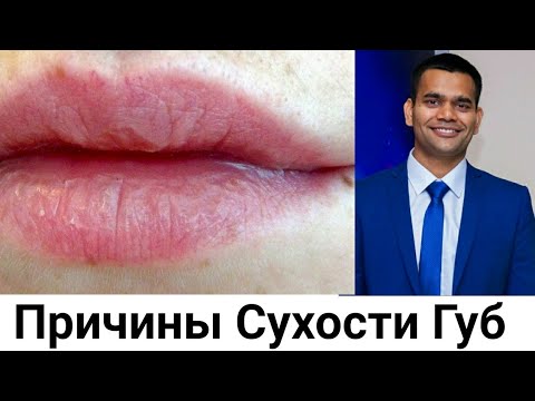 Видео: Причины Сухости Губ- Почему бывает сухие губы и как можно лечить правильно.