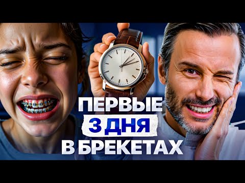 Видео: Первые 72 часа после установки брекетов. Что вас ждет?
