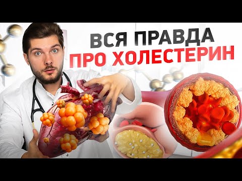 Видео: Как снизить холестерин? / Простые способы снижения холестерина