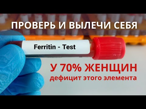 Видео: УСТАЛОСТЬ без причины? Проверь ФЕРРИТИН