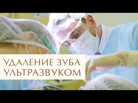 Видео: 🔬 Удаление зуба аппаратом Пьезотом: быстро, точно и без боли. Удаление зуба Пьезотомом. 12+