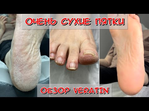 Видео: Очень сухие пятки / Педикюр для тёти / Обзор VERATIN
