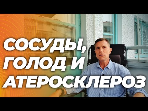 Видео: Можно ли верить слухам об атеросклерозе у узников концлагерей ?
