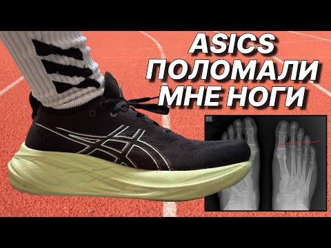 Видео: ASICS NIMBUS 26 Идеальны для Новичка, но есть Нюансы