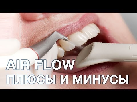 Видео: Что такое чистка зубов air flow? Плюсы и минусы данной чистки