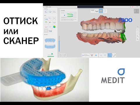 Видео: Что лучше? Аналоговый оттиск против цифрового оттиска!