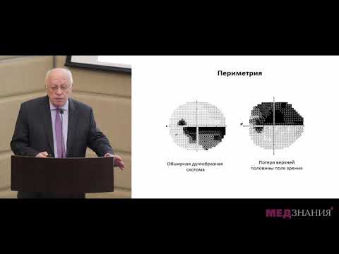 Видео: 11 Глаукома с псевдонормальным давлением