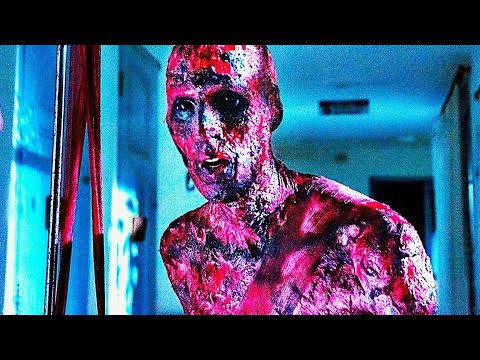 Видео: Сгоревший заживо пациент умоляет врачей прекратить его мучения... [краткий пересказ]