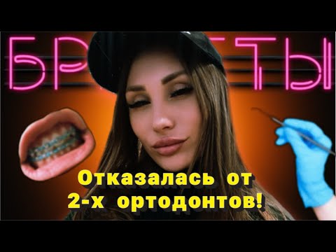 Видео: МОЯ ИСТОРИЯ БРЕКЕТОВ