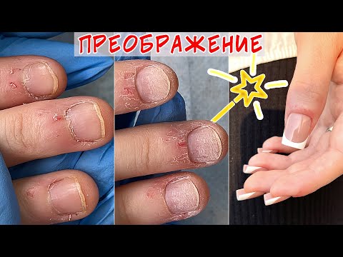 Видео: Налипшая кутикула / Преображение ногтей - френч гель лаком
