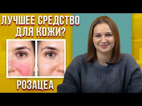 Видео: Лучший способ ИЗБАВИТЬСЯ от РОЗАЦЕА / Советы дерматолога как вылечить РОЗАЦЕА