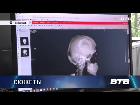 Видео: КРАНИОПЛАСТИКА