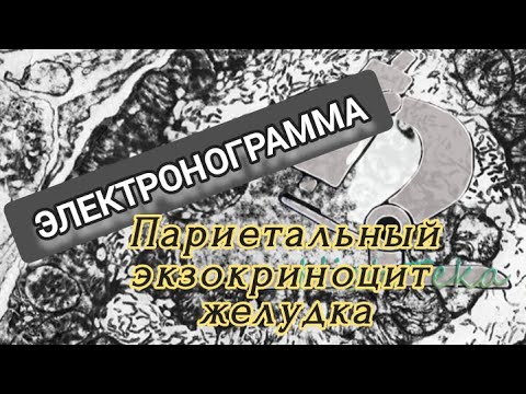 Видео: ПАРИЕТАЛЬНАЯ КЛЕТКА (электронограмма)