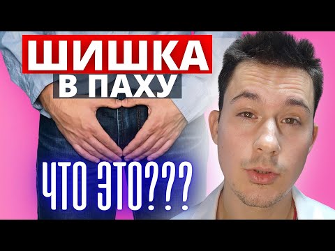 Видео: Опухоль в паху: Паховая грыжа / лимфоузел в паховой области