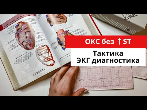 Видео: Инфаркт миокарда без подъема сегмента ST.  ЭКГ диагностика. Тактика. Часть 3.