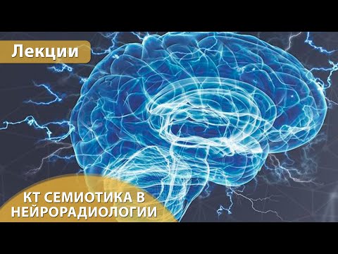 Видео: Часть 1.  КТ семиотика в нейрорадиологии.  Андрей Мангов