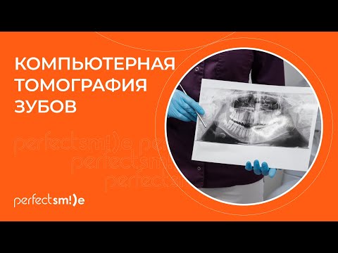 Видео: ​📍 КТ зубов