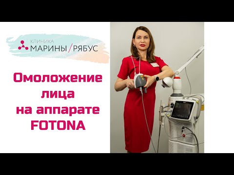 Видео: Лазерное омоложение Fotona 4D