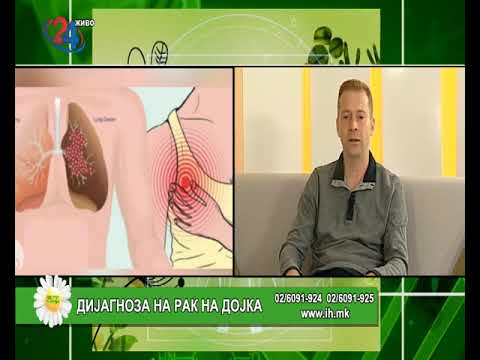 Видео: Доц. д-р Вања Филиповски : Дијагноза на рак на дојка