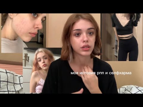 Видео: моя история рпп и селфхарма / третий год в ремиссии.