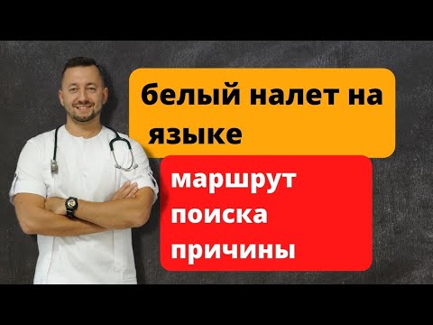 Видео: Белый налет на языке. О чем это говорит?
