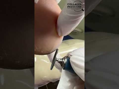 Видео: Ознакомительный урок по КОЛЛАГЕН-ПЕДИКЮРУ, идеальный педикюр без: шелушений, щекотки, пыли, ошибок