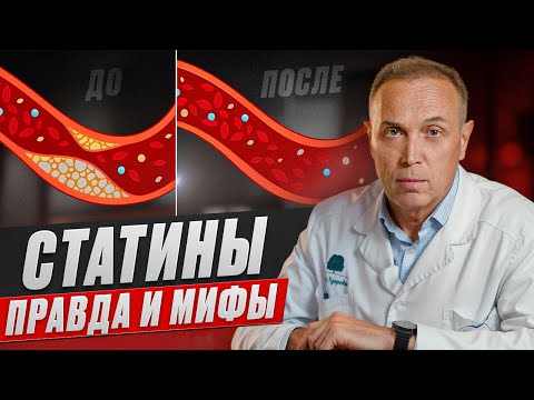 Видео: СТАТИНЫ ВЕДУТ К ДЕМЕНЦИИ???