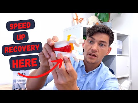 Видео: 8 способов УСКОРИТЬ время восстановления после протрузии межпозвоночного диска!