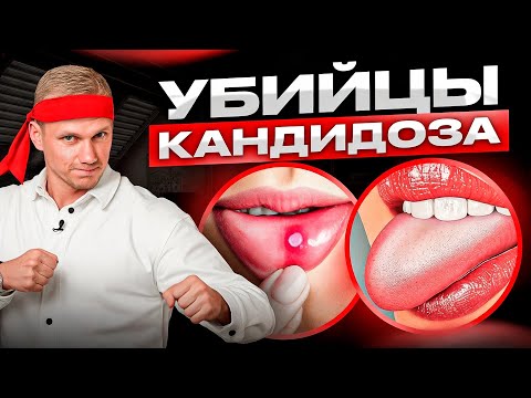 Видео: 3 средства – избавьтесь от кандидоза! Самопомощь при молочнице в домашних условиях