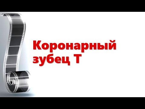 Видео: Коронарный зубец Т