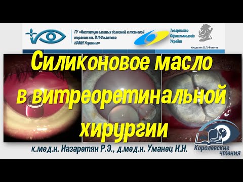 Видео: Силиконовое масло в витреоретинальной хирургии
