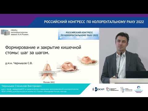 Видео: ФОРМИРОВАНИЕ И ЗАКРЫТИЕ КИШЕЧНОЙ СТОМЫ  ШАГ ЗА ШАГОМ