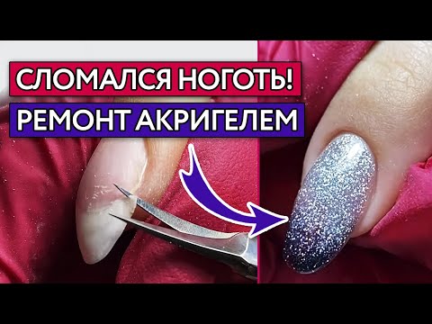 Видео: Как исправить сломанный ноготь? / Ремонт ногтя акригелем