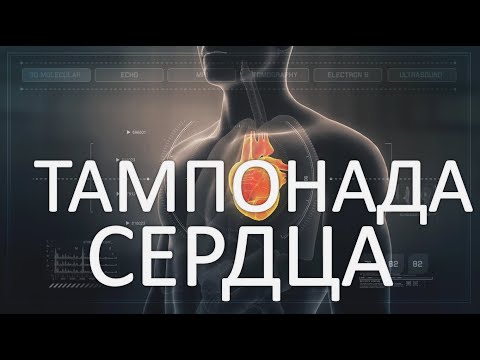 Видео: ТАМПОНАДА СЕРДЦА