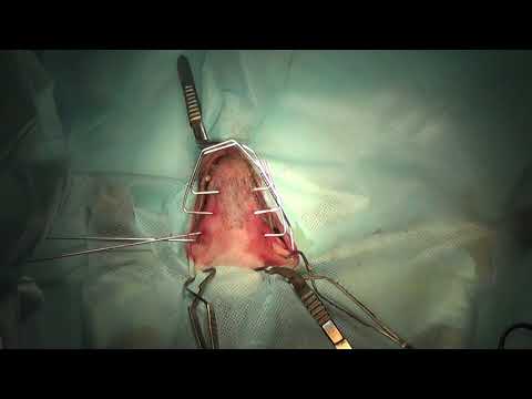 Видео: Остеосинтез при переломе нижней челюсти у собаки