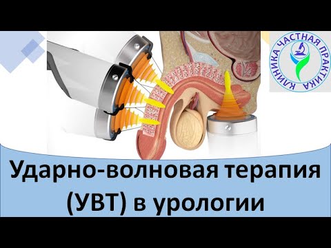 Видео: Ударно волновая терапия УВТ в урологии