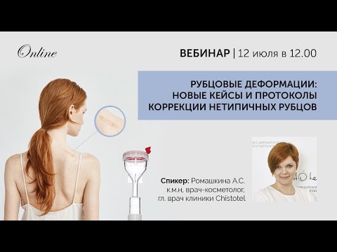 Видео: Рубцовые деформации новые кейсы и протоколы коррекции нетипичных рубцов
