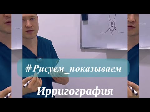 Видео: Ирригография толстой кишки зачем? когда? почему?