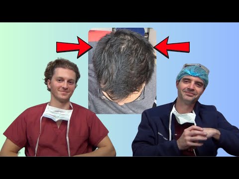 Видео: Можно ли людям с диффузными разбавителями делать пересадку волос?