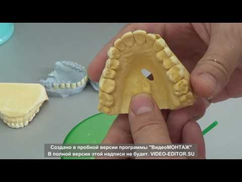 Видео: создание  каппы  для  отбеливания .др. А. Григорьев