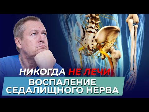 Видео: Правда о воспалении седалищного нерва: мифы и реальность