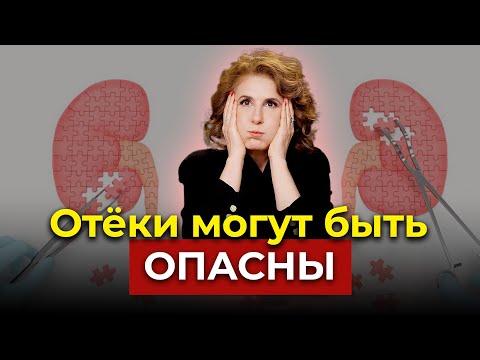 Видео: В ЧЁМ ОПАСНОСТЬ ОТЁКОВ? Ответ китайской медицины
