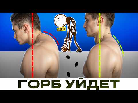 Видео: Как избавиться от холки ? Всё о горбике за 5 минут + упражнения от сутулости