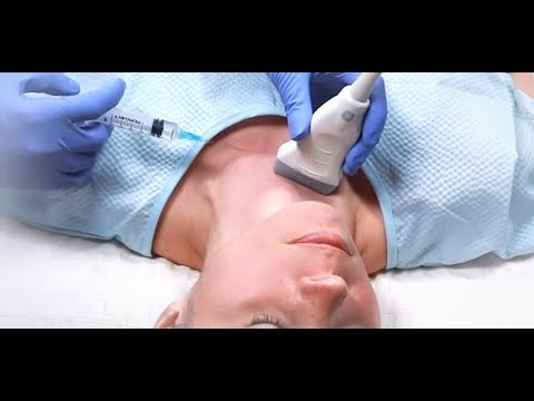 Видео: Калконсимон без САРАТОНИ  Пункция ва Биопсия усуллари УТТ назорати оркали.