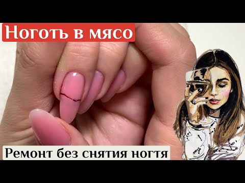 Видео: Сломала ноготь. Трещина по мясу. Ремонт без снятия ногтя. Шелк для ногтей.
