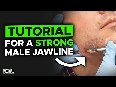 Видео: Филлеры для подбородка и линии подбородка у мужчин | Полная демонстрация процедуры