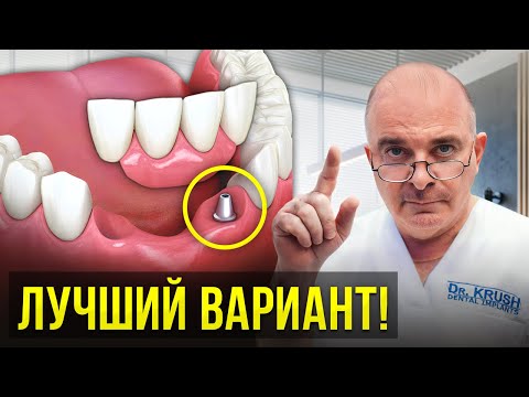 Видео: Как НЕДОРОГО восстановить зубы в 2023 году! Протезы или импланты?